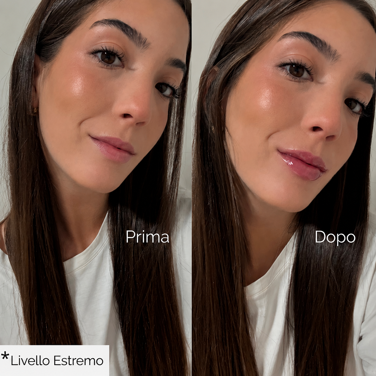 Volumizzante per labbra