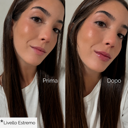 Volumizzante per labbra